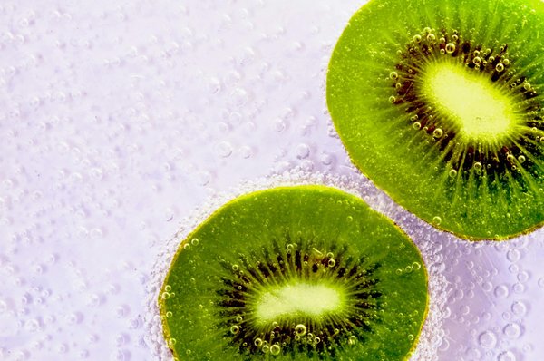 Découvrez les bienfaits du kiwi pour les femmes enceintes
